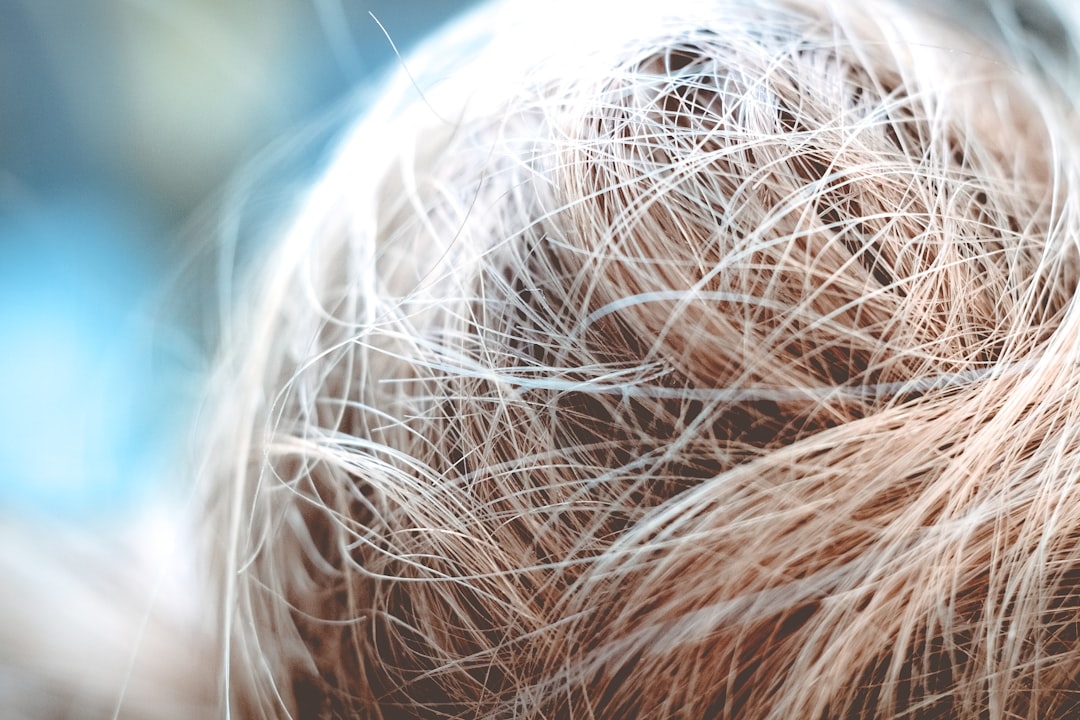 Does PRP Work for Hair Loss? What the Science and Patients Really Show
