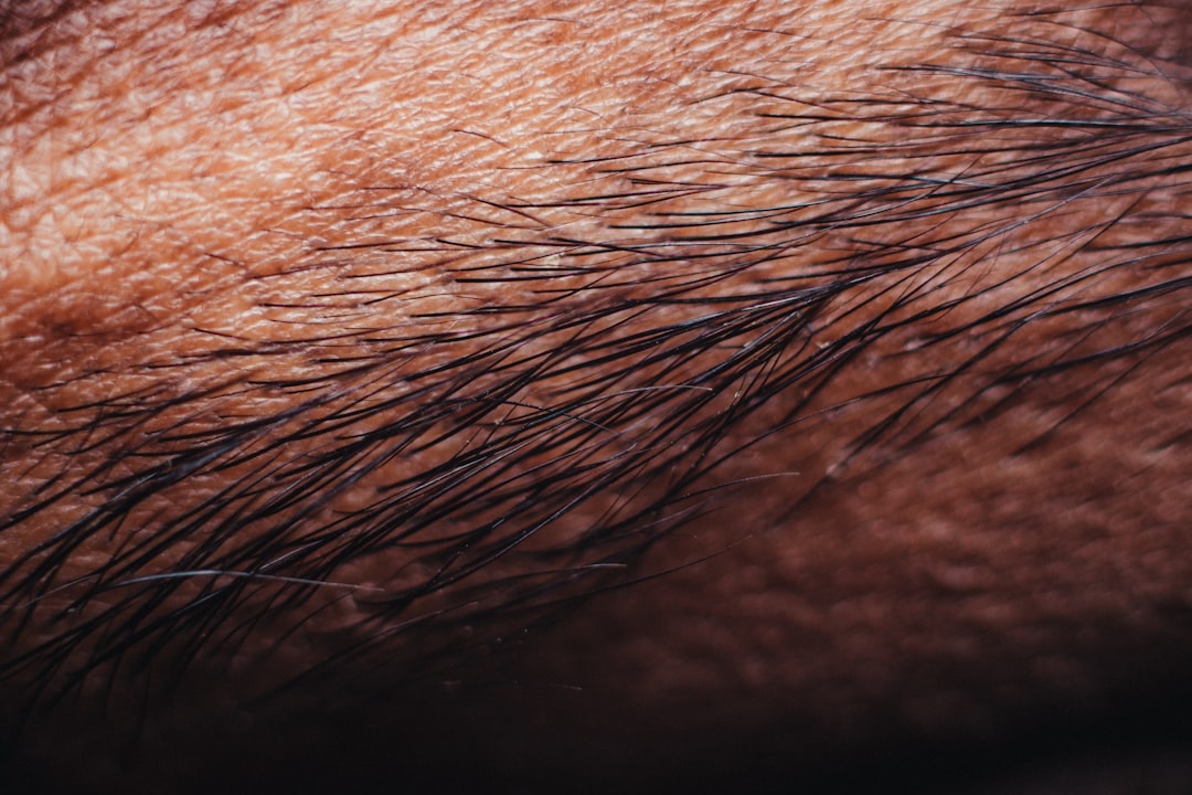 What Does Thinning Hair Look Like? A Complete Visual Guide
